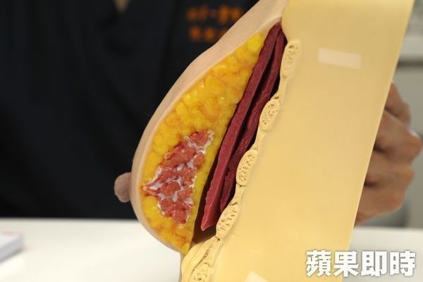 此為乳房剖面圖,產後乳腺組織(圖最中間肉色腺體)萎縮會使胸型變得下垂。